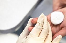 Sidaction : la HAS veut renforcer le dépistage pour éradiquer l’épidémie