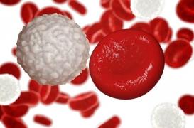 La moitié des leucémies myéloïdes chroniques en rémission prolongée sans aucun traitement