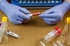 Zika : le virus ne se transmettrait pas par la salive