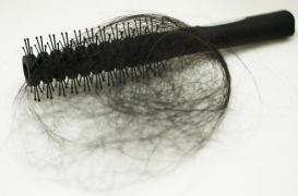 Calvitie précoce : la rappeuse Paigey Cakey sensibilise son public sur l’alopécie de traction 