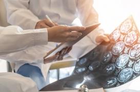 AVC : les premiers symptômes peuvent apparaître dix ans avant