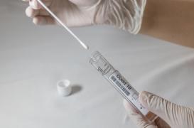 Covid-19 : une nouvelle méthode permet de repérer les personnes à risque de formes graves 