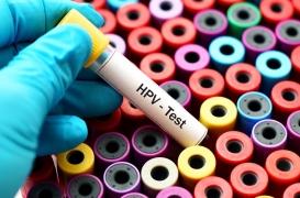 Cancer du col de l'utérus : le test HPV recommandé aux femmes de plus de 30 ans 