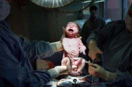 Cytotec, l’anti-ulcère utilisé pour accoucher, est retiré du marché français