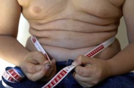 Psoriasis : la perte de poids réduit les symptômes