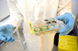 Moelle osseuse : des chercheurs réalisent une greffe sans chimiothérapie
