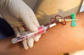 Tuberculose : un plan pour l'éradiquer à l'horizon 2035