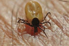 Maladie de Lyme : le nombre de cas explose au Royaume-Uni 