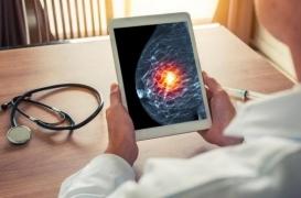Cancer du sein : l'IA pour améliorer le diagnostic 