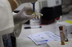 Zika : le virus peut persister six mois dans le sperme