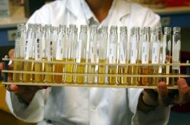 Cancer du pancréas :  un test urinaire pour dépister précocement