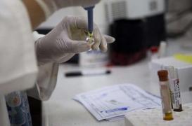 Zika : un candidat-vaccin suscite l'espoir 