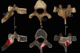 Cancer : découverte de tumeurs vieilles de 2 millions d’années