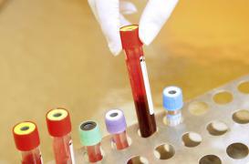 VirScan : une goutte de sang pour retrouver toutes ses infections virales 