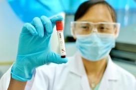 Pourquoi le virus chinois effraie la France et le monde 