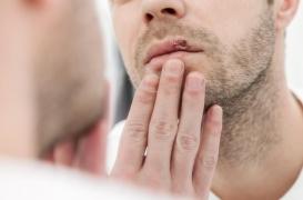 Alzheimer : un lien possible entre la maladie et des virus comme l'herpès