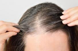 Le stress nous fait bien des cheveux blancs