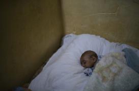 Zika : le virus continue à se répliquer dans le cerveau des bébés 