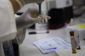 Zika : une Française infectée par son conjoint