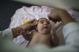 Zika : un premier cas de microcéphalie à Hawaii