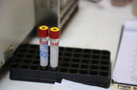 Zika : un homme l'aurait transmis à sa femme malgré une vasectomie