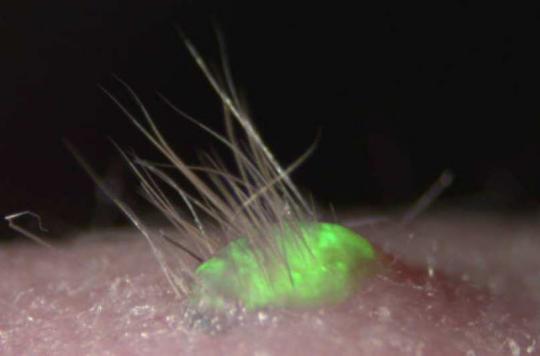 Des chercheurs créent une peau artificielle avec des poils
