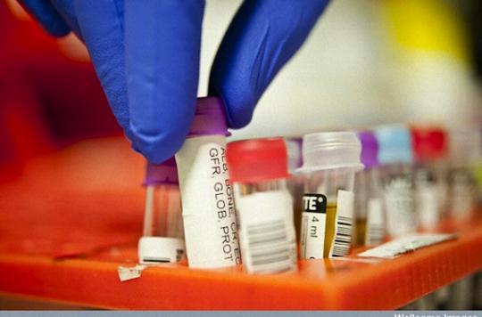 Un Test Pour Le Diagnostic Precoce De La Sclerose En Plaques