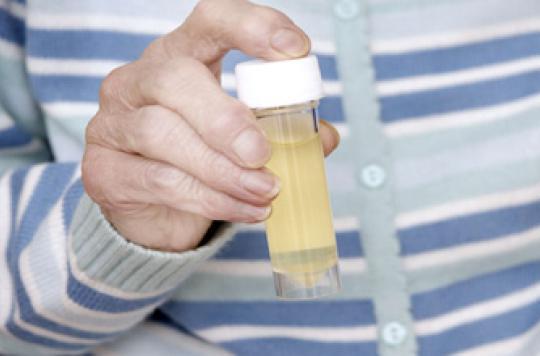Cystite : les tests urinaires manquent d'efficacité