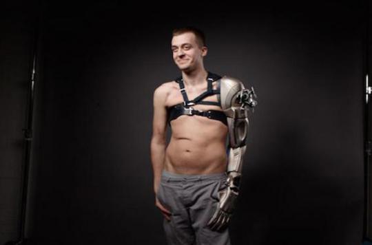 Handicap : un Anglais reçoit une prothèse inspirée d'un jeu vidéo