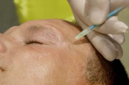 Injections de Botox : le Royaume-Uni durcit la législation