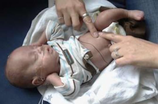 Prematurite Un Couple Denonce L Acharnement Therapeutique Sur Leur Bebe