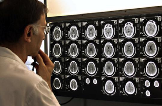 Les lésions cérébrales triplent le risque de décès prématuré