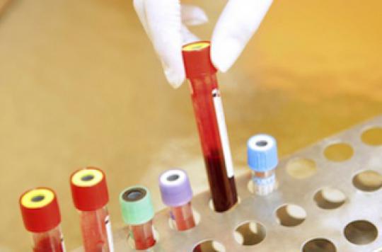 Un test sanguin à l'étude pour détecter tous les cancers 