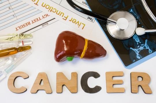 Cancer du foie : un essai d'immunothérapie cellulaire à Rennes