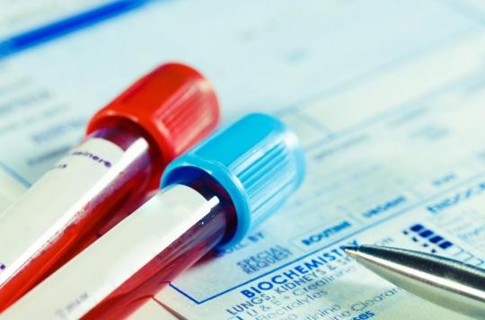 Fibromyalgie : l’espoir d’un test sanguin pour diagnostiquer la maladie