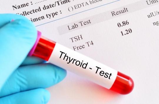 Cancer de la thyroïde : un nouveau test permettrait d’éviter les chirurgies inutiles 