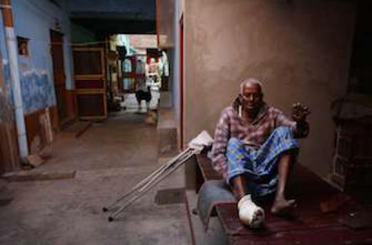 Lèpre : des malades de plus en plus contagieux