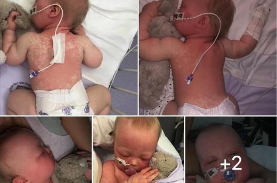 Son bébé de 5 mois attrape la rougeole, elle accuse les anti-vaccins