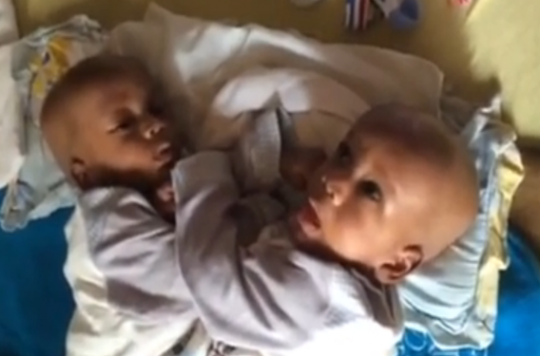 9 Bebes Siamois Sur Dix Sont Des Filles