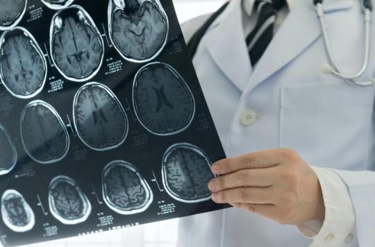 Pourquoi la Covid-19 augmente le risque d’accident vasculaire cérébral ? 