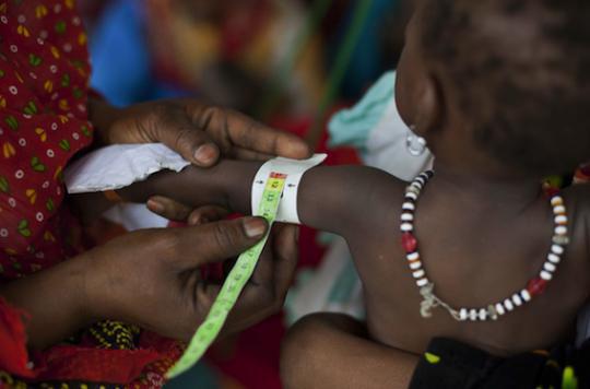 Malnutrition infantile : MSF remet en cause le recours systématique aux antibiotiques 