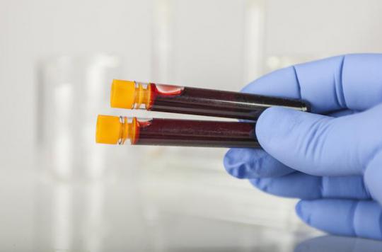 VIH : des chercheurs de Montpellier font une découverte majeure sur les cellules-réservoirs