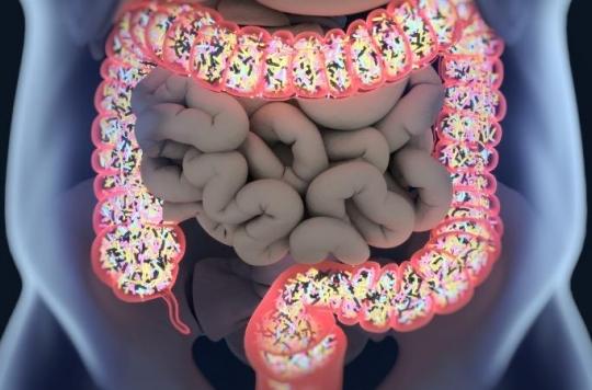 Un microbiome intestinal sain est meilleur pour les artères 