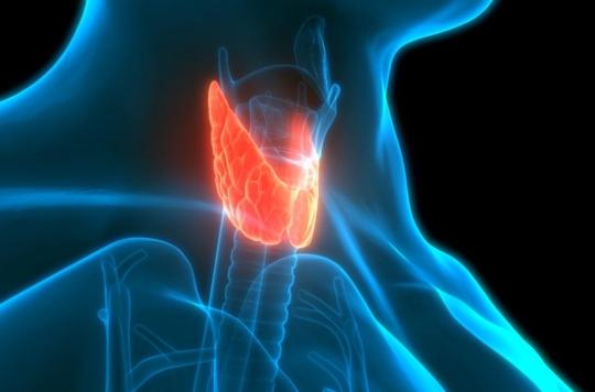 Ce banal trouble de la thyroïde pourrait développer la maladie d’Alzheimer