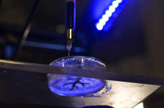 Des chercheurs impriment en 3D des artères coronaires 