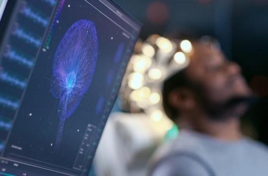 L'intelligence artificielle pourrait détecter la maladie d'Alzheimer six ans avant un diagnostic humain