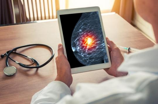 Cancer du sein : inquiétude face à la baisse des dépistages en 2020