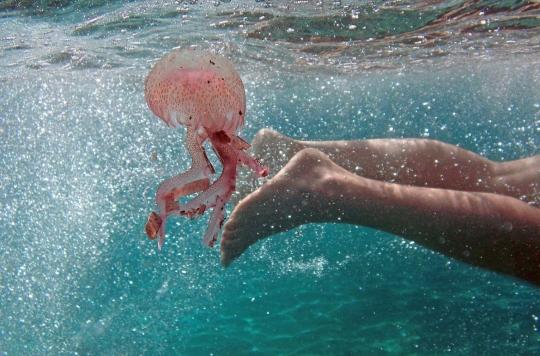 Comment soigner une piqûre de méduse