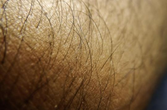 Des scientifiques créent pour la première fois de la peau humaine avec des poils