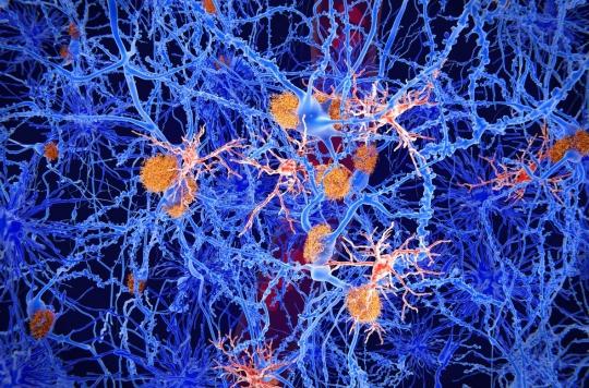 Alzheimer : le processus de création de nouveaux neurones impliqué dans la maladie